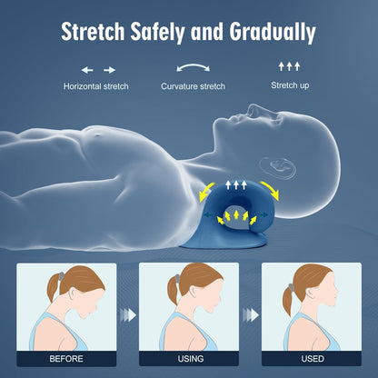 Neck Stretcher for Pain Relief, Neck and Shoulder Relaxer Cervical Traction Device Pillow for Muscle Relax and TMJ Pain Relief (Blue)
