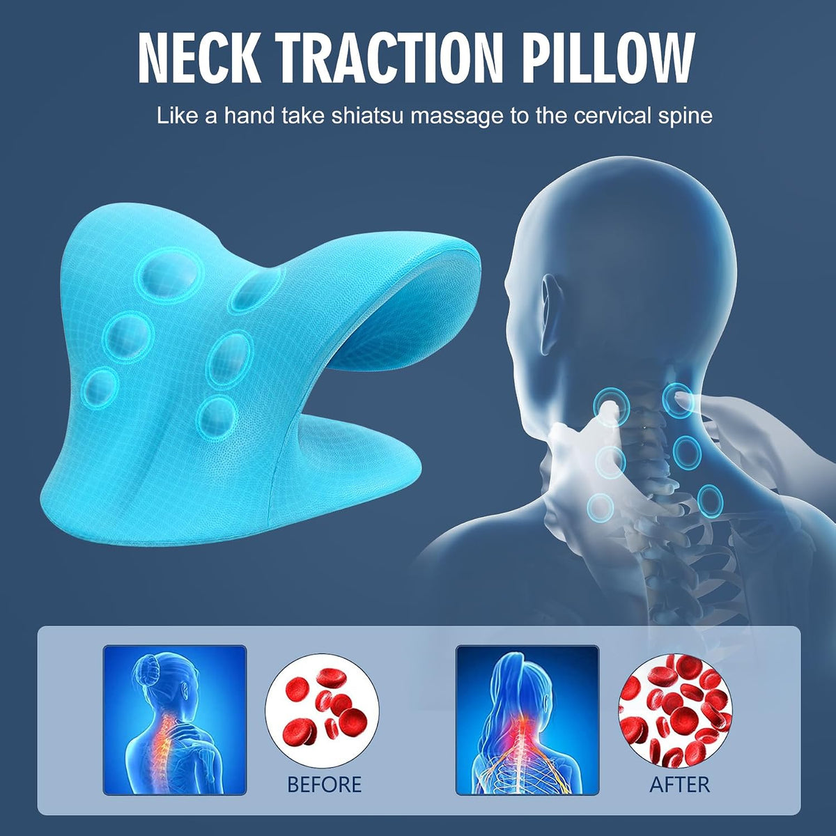 Neck Stretcher for Pain Relief, Neck and Shoulder Relaxer Cervical Traction Device Pillow for Muscle Relax and TMJ Pain Relief (Blue)